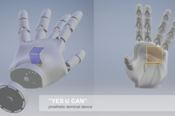 yes you CAN - prosthetic terminal device
