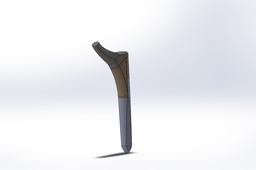 Hip Implant