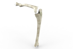 Left leg