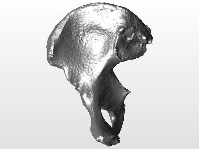 Right ilium