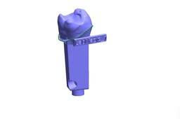 Digital Dental Implant Model