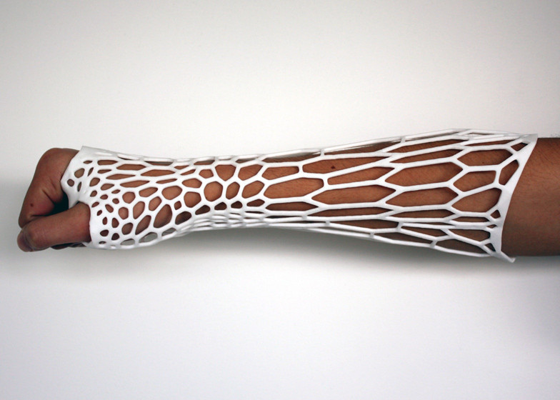 3D model of medical and orthopedic wrist