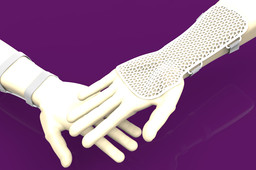 SGCHL The Plastic Bank - Splint