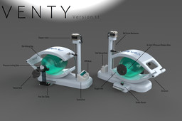 Venty (AmbuBag Ventilator)