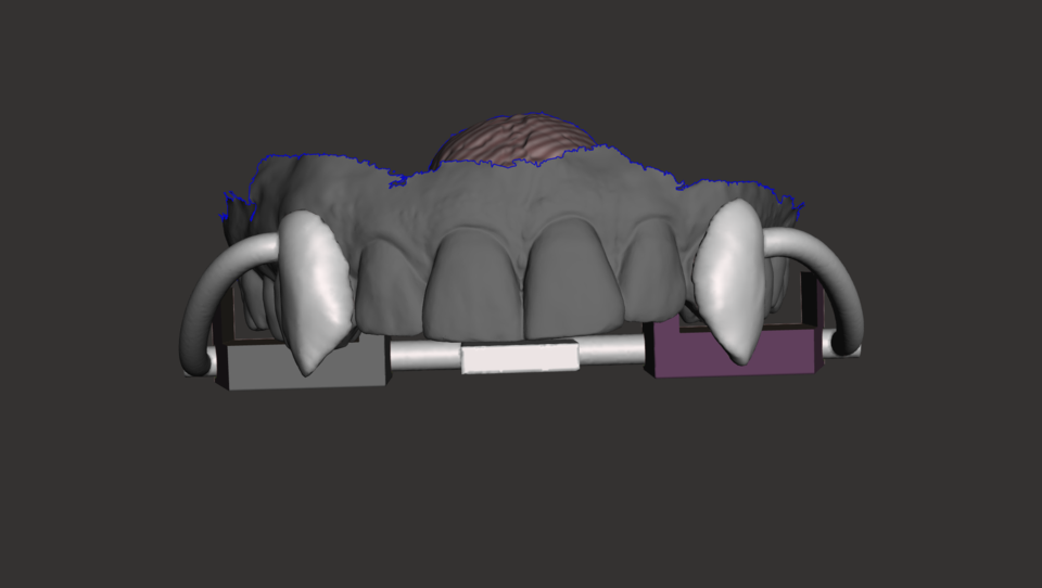 Retractable Vampire Teeth | 3D CAD Model Library | GrabCAD