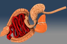 GI Tract.ics