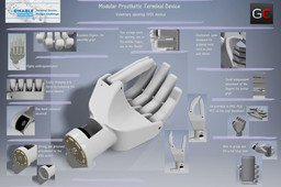 Prosthetic Hand