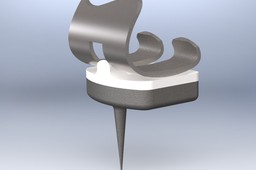 Knee Implant