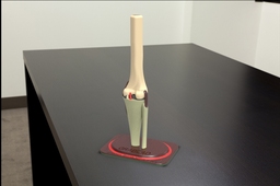 knee joint