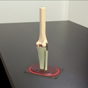 knee joint