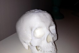 Skull 1